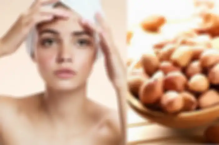 Menghindari Kacang Karena Jerawat, Kamu Justru Bisa Alami Hal Buruk ini!