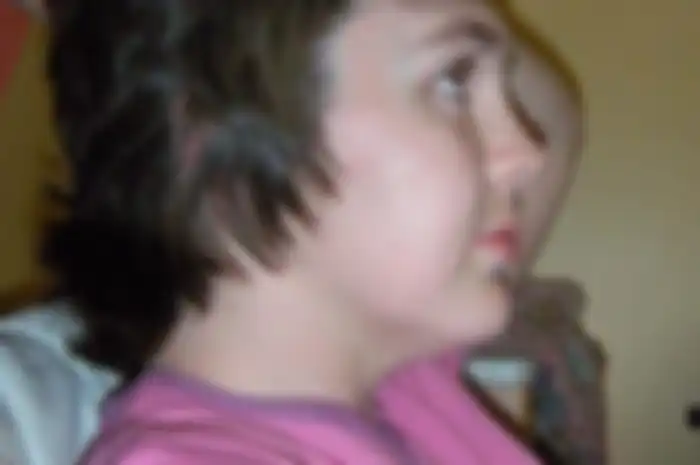 Grainne Kealy pasca kecelakaan