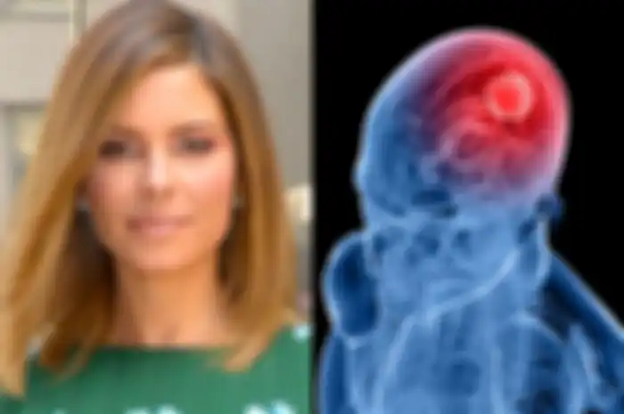 Maria Menounos idap tumor otak sebesar bola golf