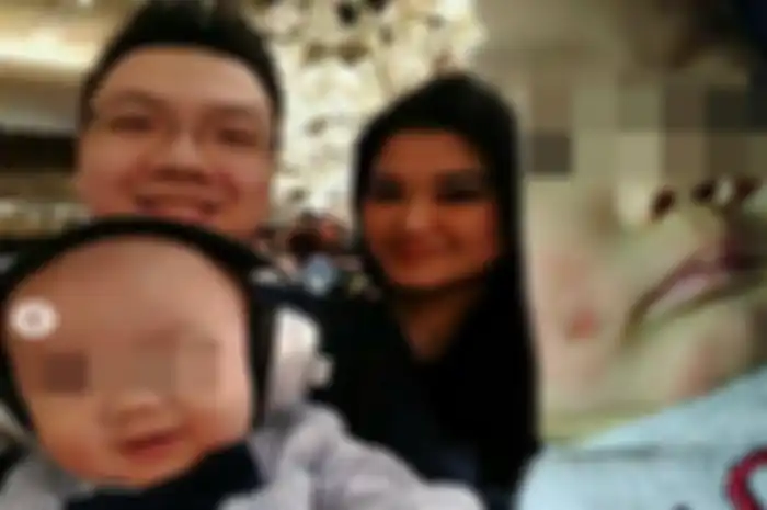 Bayi malang yang terluka parah karena dicium dan disentuh pipinya oleh banyak orang