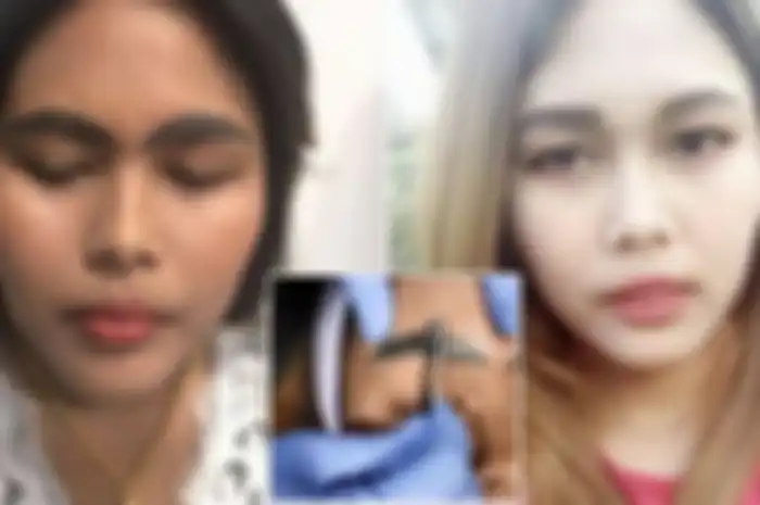 Wanita ini alami prosedur tato alis permanen yang gagal