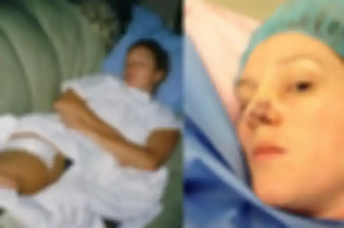Ingin Kulitnya Terlihat Lebih Gelap, Wanita ini Justru Berakhir dengan Operasi Kanker Kulit 86 Kali