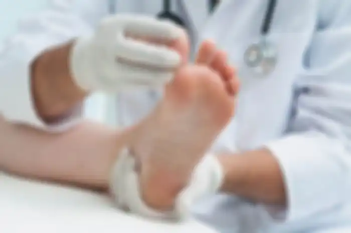 10 Tanda Penyakit Serius yang Bisa Dideteksi dari Kaki, Salah Satunya Kaki Kering dan Bersisik