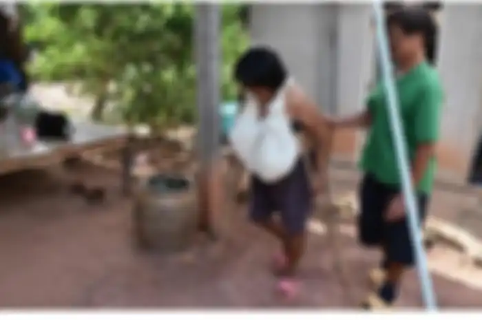 Lam Phrai Si Nuan asal Thailand,  mengalami kondisi aneh lantaran payudaranya terus membesar.(Phitsanulok Hot News via Oddity Central) 