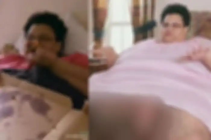 3 Tahun Selalu Terbaring di Kasur, Begini Penampilan Milla Clark MSetelah Kurus Kini!