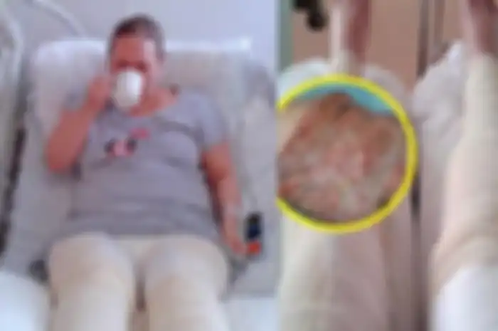 Wanita ini Koma 9 Hari dan Nyaris Meninggal Usai Cukur Bulu Kemaluannya