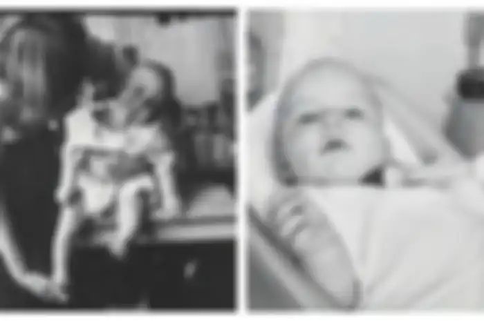 Tinggalkan Luka Bolong di Leher Sang Anak, Ibu ini Beri Peringatan Untuk Tidak Memberikan Madu Pada Bayi
