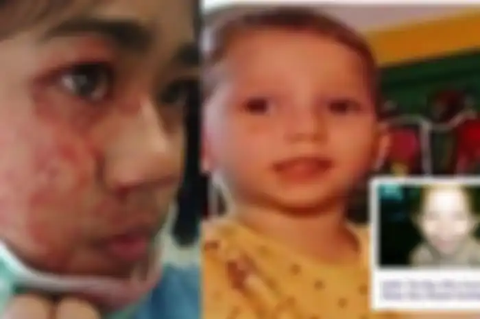 4 Kondisi Medis Langka di Dunia, Dari Nangis Darah Hingga Anak yang Tak Bisa Tidur 24 Jam Selama Setahun!