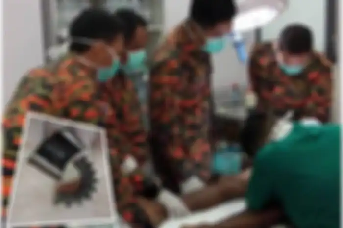 Gear persneling tersangkut di alat vital seorang pria.