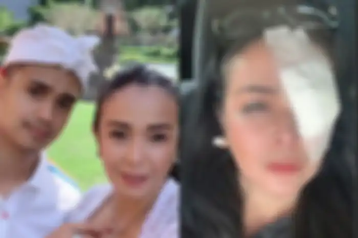 Istri Ajun Perwira, Jennifer Jill, tiba-tiba tampil dengan mata kiri diperban. Baru 3 bulan menikah dengan Ajun, apa yang terjadi?