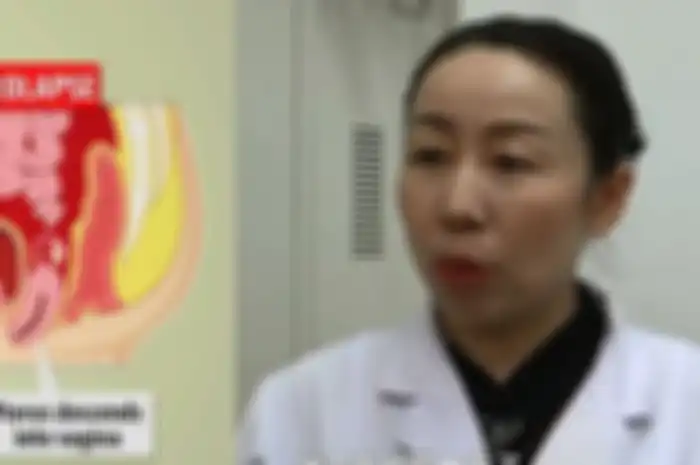 Wanita ini Menari Terlalu Keras Hingga Rahimnnya 'Jatuh', Begini Penjelasan Medis