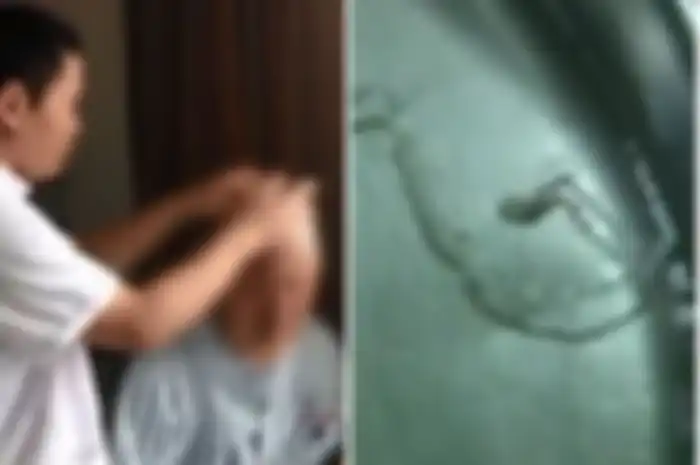 Dikira Idap Epilepsi Karena Alami Kejang-KejangParah, Pria ini Langsung Sembuh Saat Dokter Berhasil Keluarkan Benda ini dari Tengkoraknya
