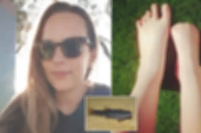 Lakukan Spa Ikan, Wanita ini Justru Harus Kehilangan Jari Kaki Kanannya!
