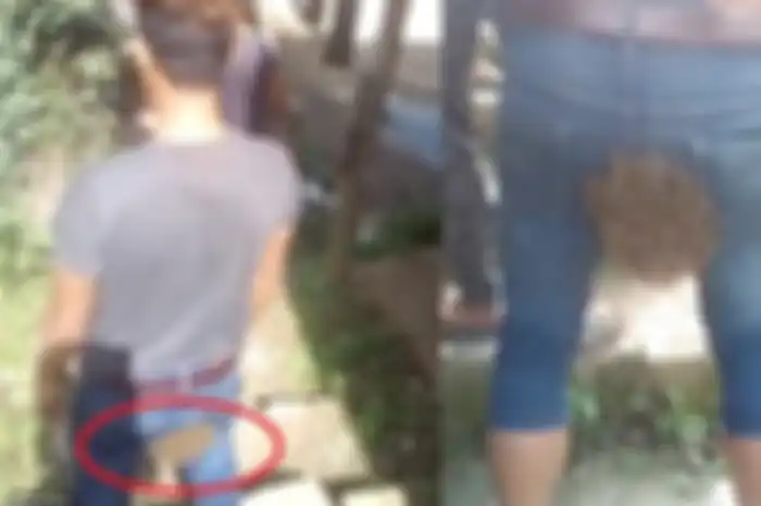 Pria ini Tak Sadar Jika Bokongnya Dihinggapi Ratusan Lebah, Hingga ia Mendengar Suara Denging Saat Berjalan