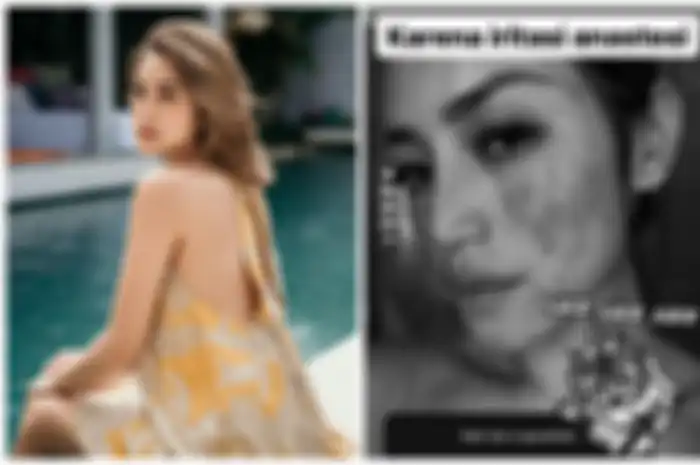 Wajah Jessica Iskandar Merah-merah Sampai Dibilang Mengerikan, Tanggapan Richard Kyle di Postingan Jedar Banjir Pujian