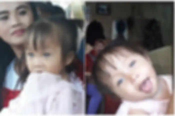 Amelia Anggraeni, bocah 2 tahun asal Bandung yang matanya bisa berubah-ubah warna
