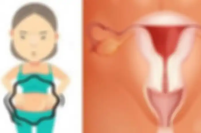Jangan Dianggap Sepele, 10 Tanda Pada Tubuh ini Jadi Ciri Wanita Terkena Kanker Ovarium: Berat Badan Menyusut Hingga Perut Kembung