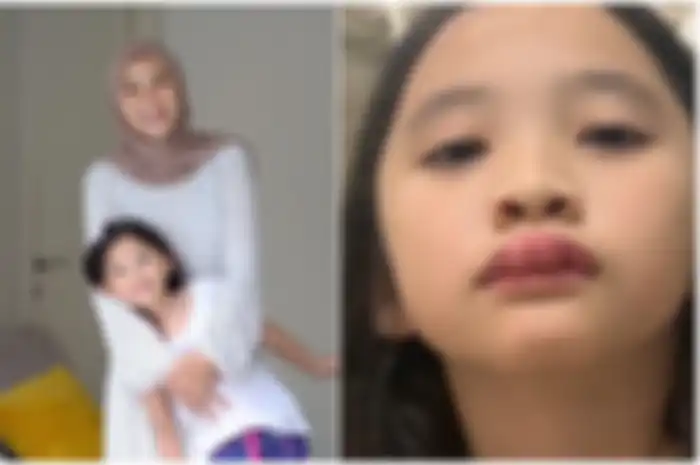 Alergi Kucing Parah, Anak Zaskia Adya Mecca Alami Bibir Bengkak Sampai Mata Bengep