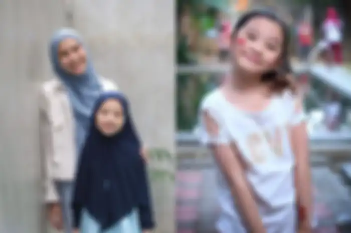 Putri sulung zaskia alami alergi kucing