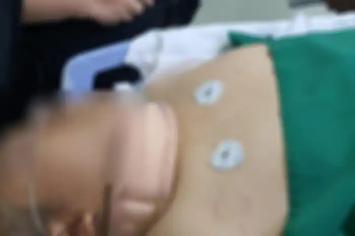 Faisal Amir (21) sebelum menjalani operasi di RS Pelni, Slipi, Palmerah, Jakarta Barat. 