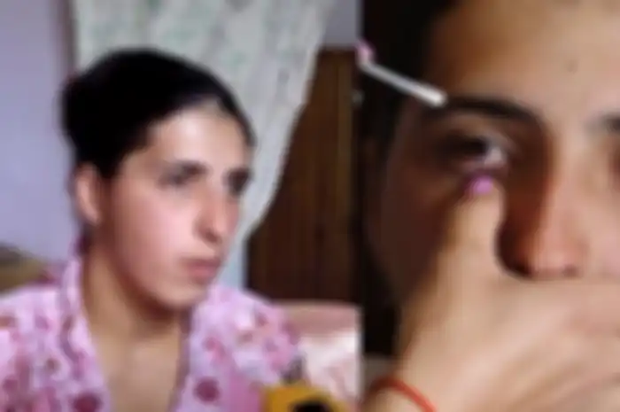 Bak Putri Duyung, Wanita Asal Armenia ini Keluarkan Permata Ketika Menangis, Bukannya Senang Justru Ia Merasa Tersiksa