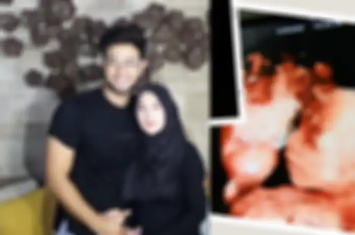 Irish Bella dan Ammar Zoni kehilangan bayi kembarnya, Minggu (6/10/2019) lalu.