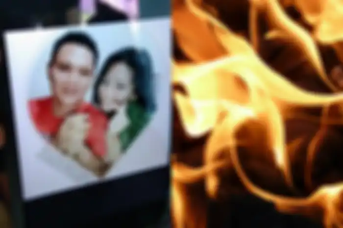 Kondisi wanita yang dibakar suaminya hidup-hidup