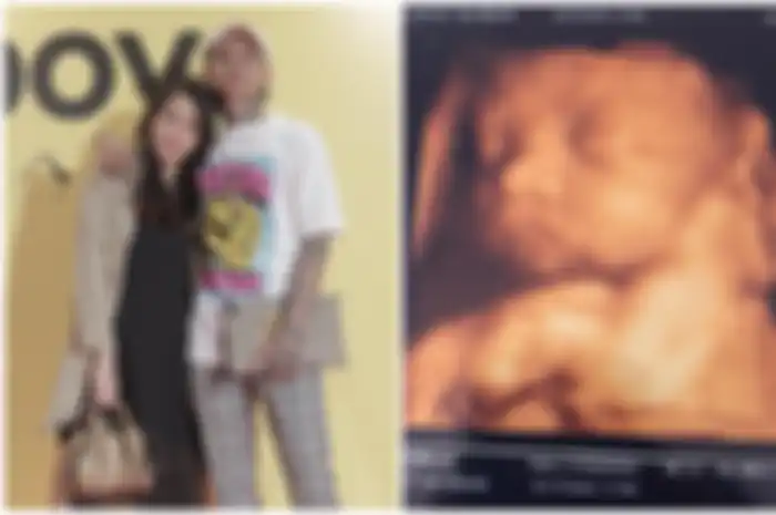 Young Lex unggah foto USG sang kekasih