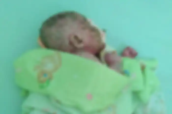 Mizyan Haziq Abdillah, bayi berusia 6 bulan dari wilayah perbatasan Kabupaten Nunukan ini menderita penyakit, kulitnya mengeras seperti plastik kemudian pecah dan mengelupas.