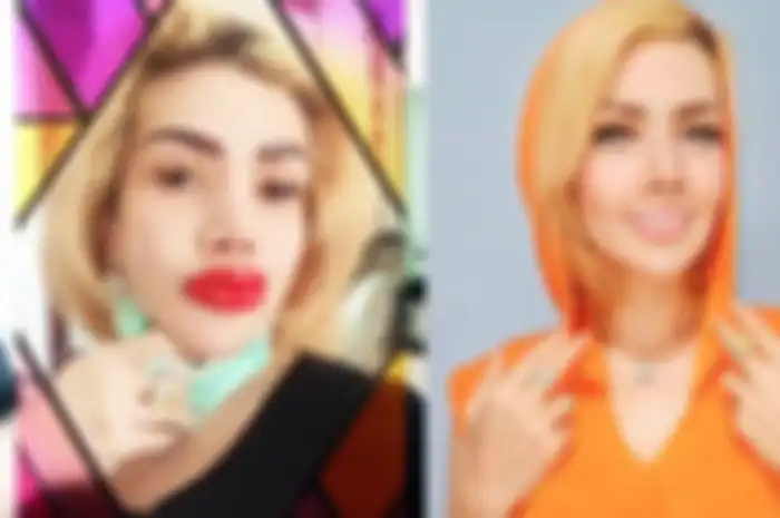 Barbie Kumalasari Menyesal Bibirnya Berubah Drastis? Cara Bicara Jadi Beda, Istri Galih: Kayak KDRT!  