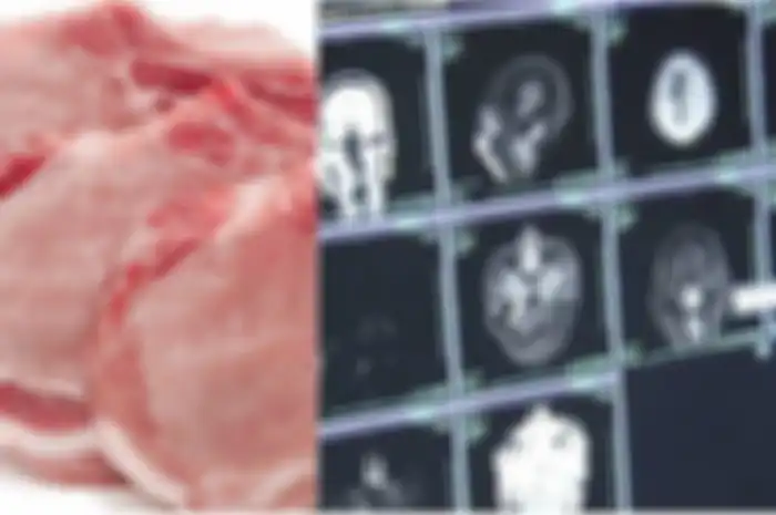 Dokter Temukan 700 Hewan Menjijikan ini Bersarang di Dalam Otak Pasiennya, Salah Satu Penyebabnya Karena Sering Konsumsi Daging Babi