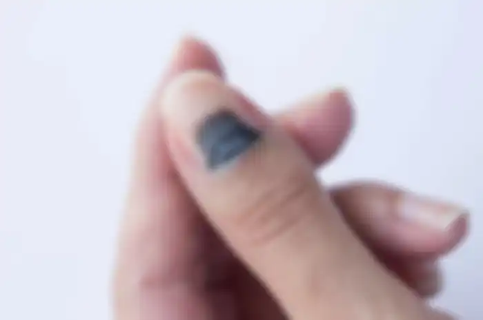 Garis hitam pada kuku yang merupakan tanda penyakit