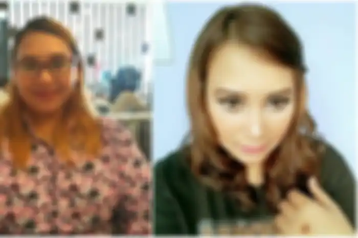 Punya 9 Kepribadian, Anastasia Wella: Kenapa Ada Sosok Orang Lain di Tubuh Saya