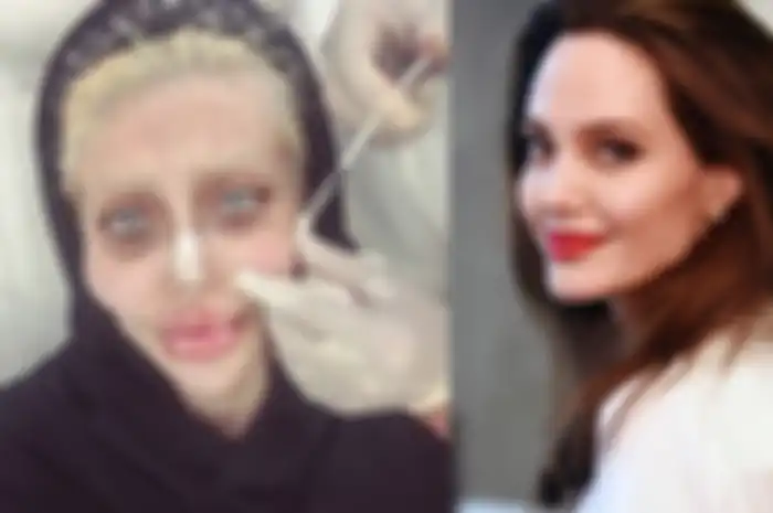 Lakukan Operasi Plastik Agar Mirip dengan Angelina Jolie, Begini Kabar Sahar Tahar Kini