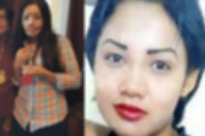 Kabar terkini Lisa setelah 14 tahun berlalu pasca wajahnya disiram air keras oleh suaminya sendiri