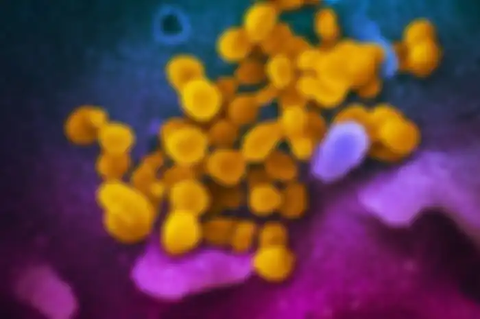 Potret virus corona Wuhan (kuning) di antara sel manusia (biru dan ungu) yang dilihat dari miskroskop elektron pemindai 