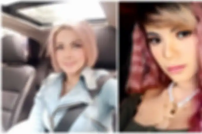 Ngaku Dipukul Dinar Candy Hingga Hidungnya Bengkok, Barbie Kumalasari: Kalo Ada Artis Lain Ngetop, Dia Juga Mau Ikutan Naik!