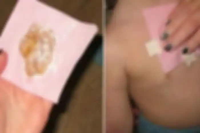 obat alami hilangkan dahak