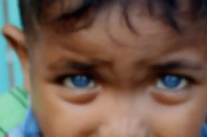 Seorang bocah di Desa Boneatiro, Kecamatan Kapuntori, Kabupaten Buton Sulawesi Tenggara, Fardan Ramadhan (5), memiliki sepasang mata yang berwarna biru di kedua bola matanya. 