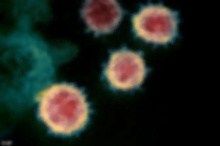 Pewarnaan hasil tangkapan mikroskop elektron yang tunjukkan kapsid virus berwarna biru sedangkan RNA/DNA di dalamnya berwarna merah dan kuning