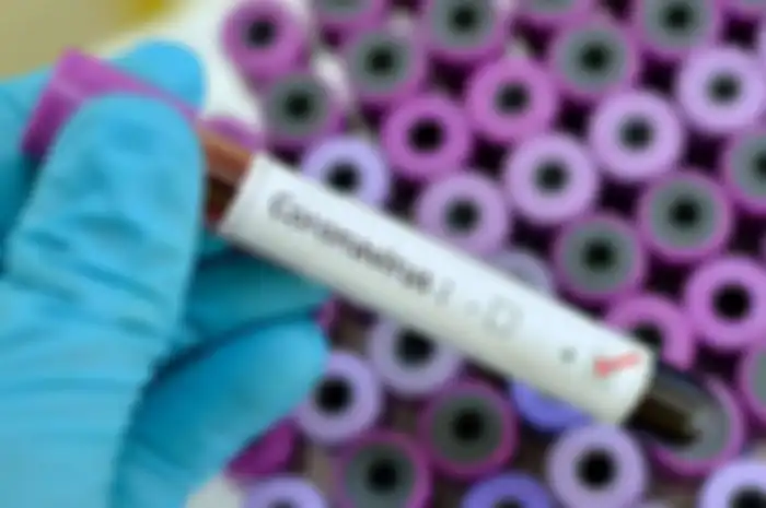 Virus corona atau Covid-19