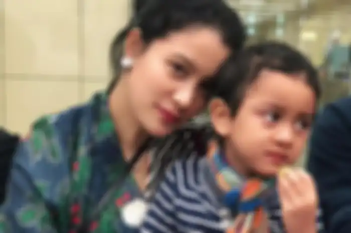 Anak Marcella Zalianty terkena tumor otak