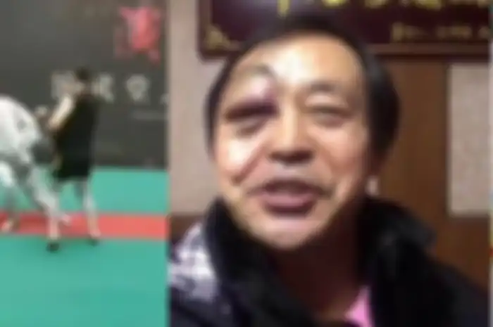 Master Tai Chi, Ma Baoguo tampak babak belur usai petarung MMA amatir Wang Qingmin 