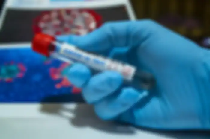 Virus Covid-19