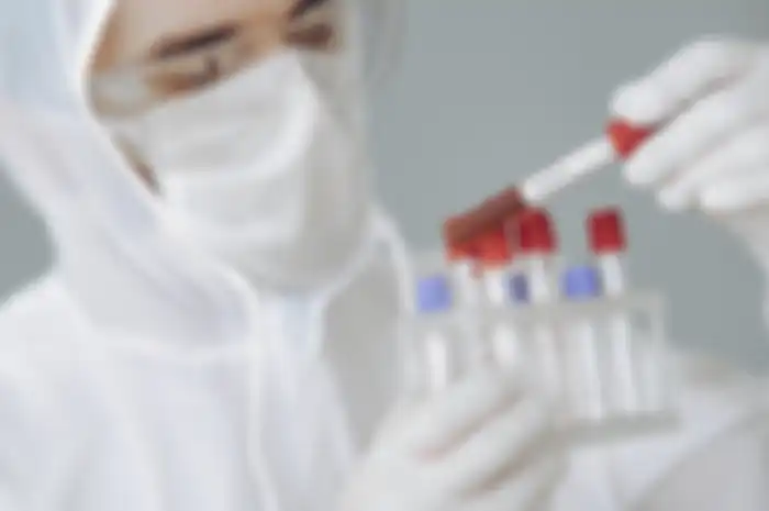 Ilustrasi hasil rapid test virus corona.
