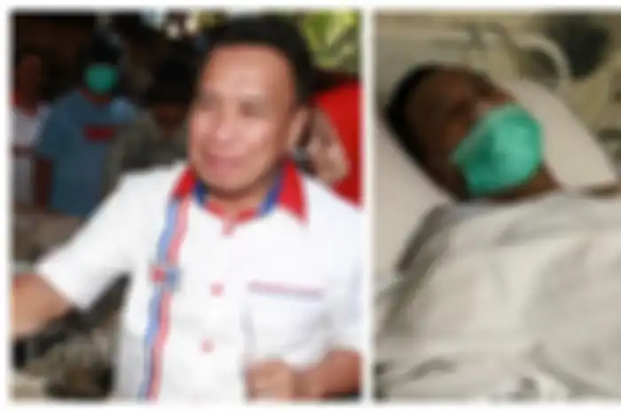 Komedian Miing Bagito baru saja lakukan operasi pengangkatan batu empedu