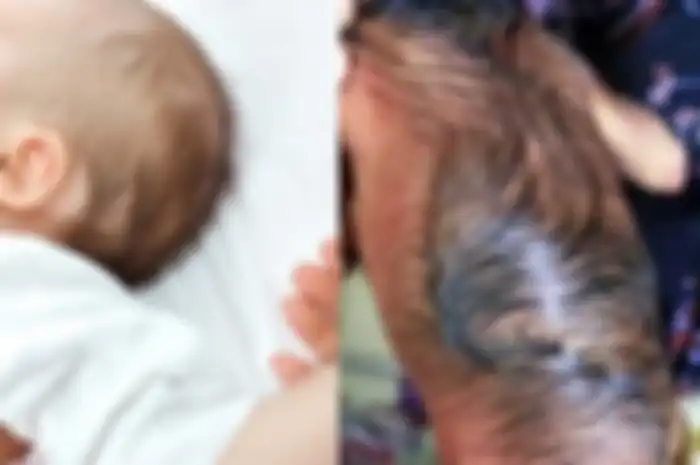 Bayi ini Dilahirkan dalam Kondisi Tak Lazim Hingga Membuat Ruangan Operasi Gempar, Orang Tua ini Justru Berikan Reaksi Tak Terduga dengan Konsidi Fisik Anaknya