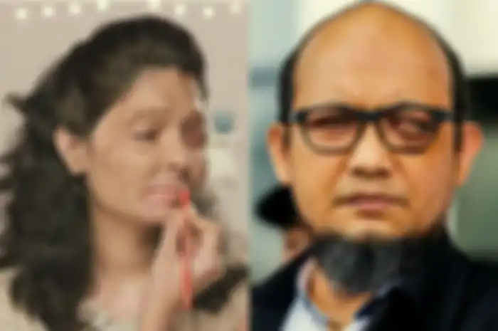 Jadi Tanda Tanya Besar, Kulit Wajah Novel Baswedan yang Tetap Mulus Meski Usai Disiram Air Keras, Kok Bisa?