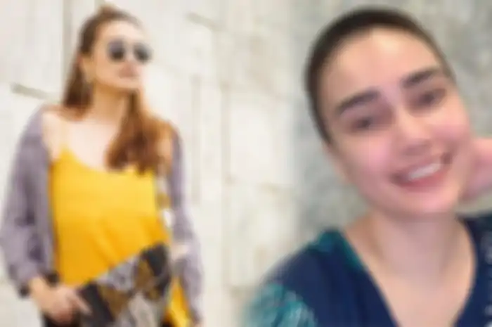 Feby Fabiola mengaku kehilangan rambut karena kemoterapi yang dijalaninya.