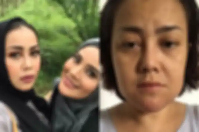 Elma Theana, Rency Milano yang diketahui kena malpraktik klinik kecantikan